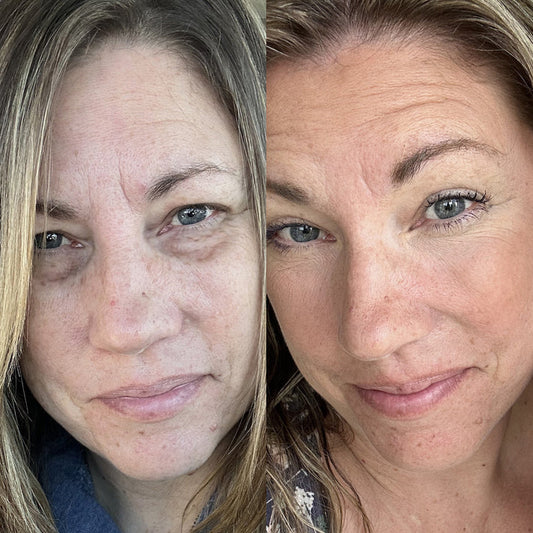 Healix® RevitalEyes