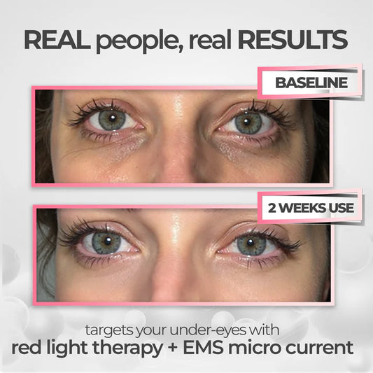 Healix® RevitalEyes