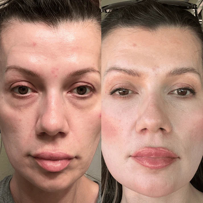 Healix® RevitalEyes