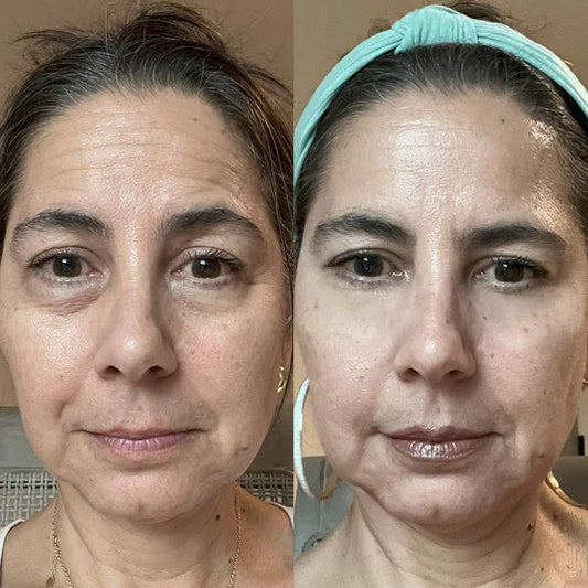 Healix® RevitalEyes