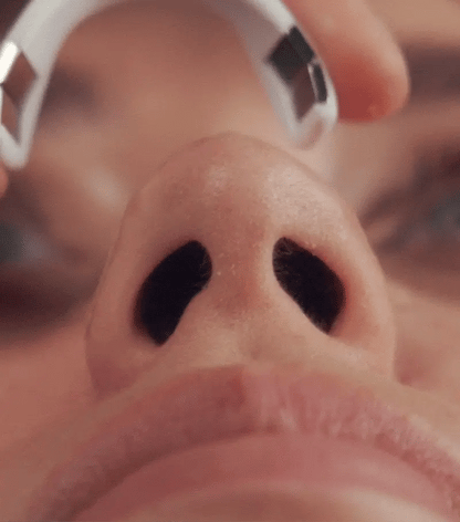 Healix® Intake
