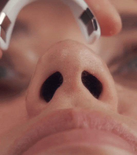 Healix® Intake